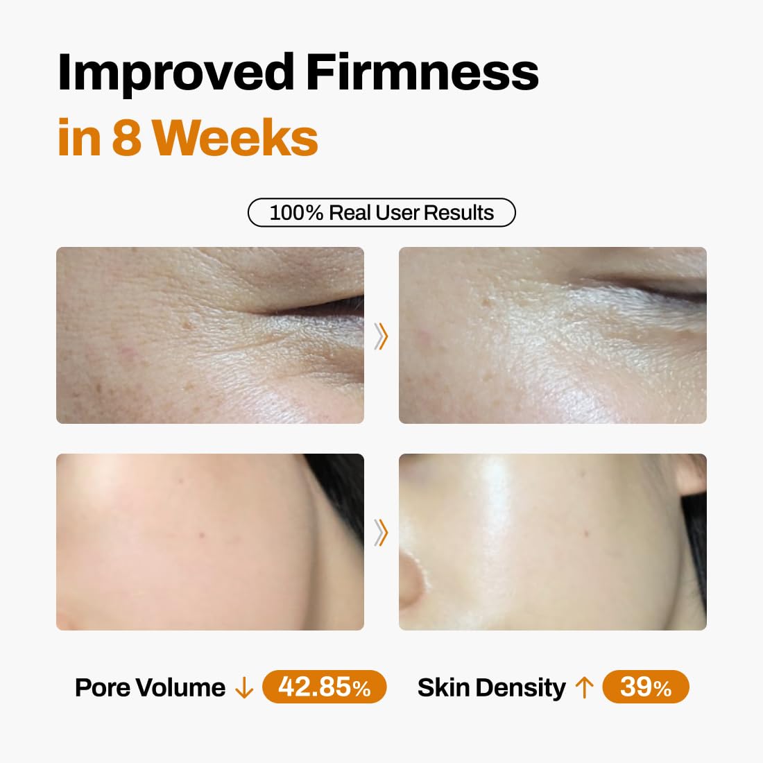 TimeLift 8-Week Sculpting System