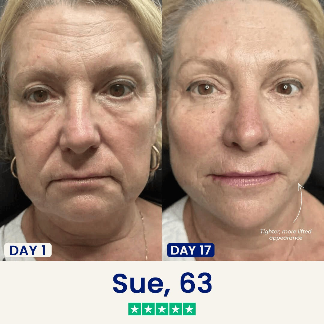 Iridelle V-Lift Sculpting Mask