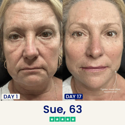 Iridelle V-Lift Sculpting Mask