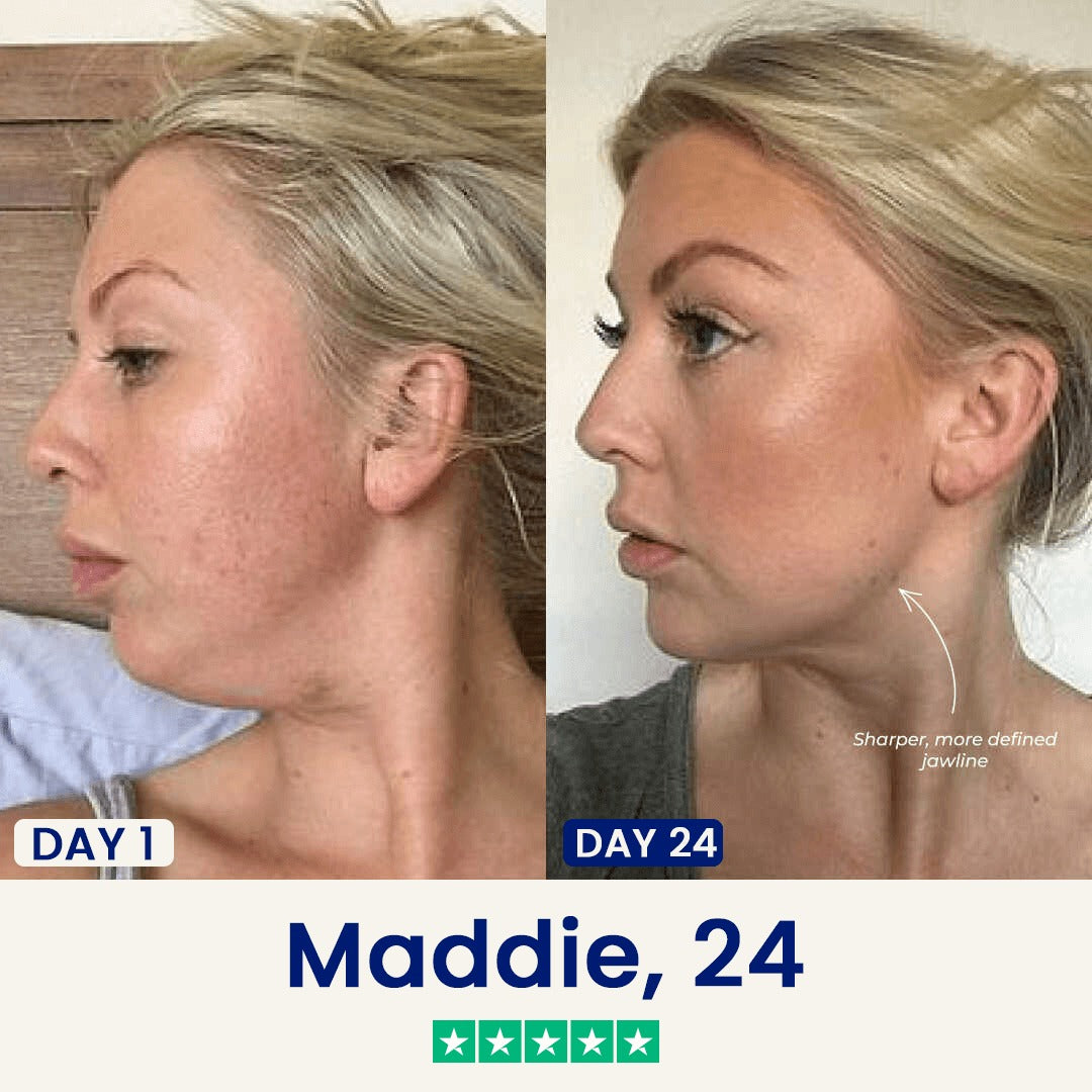 Iridelle V-Lift Sculpting Mask
