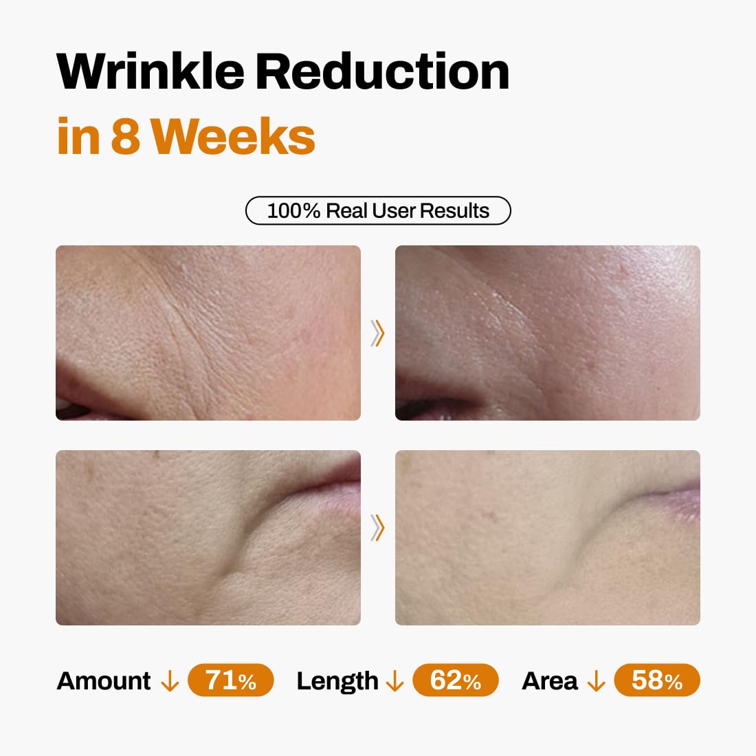 TimeLift 8-Week Sculpting System