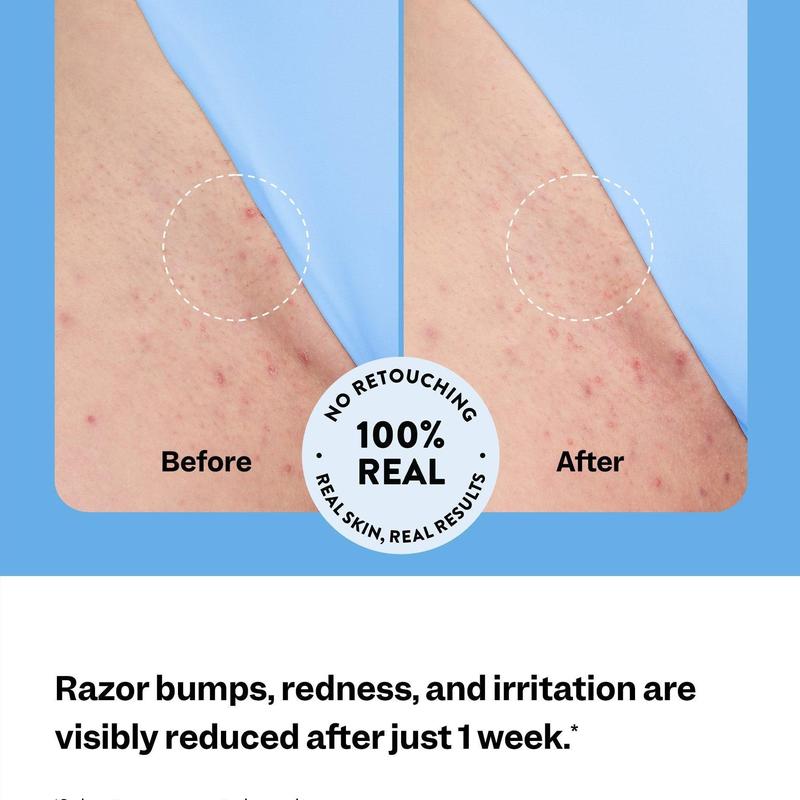 Iridelle SmoothStick Ingrown Hair Relief